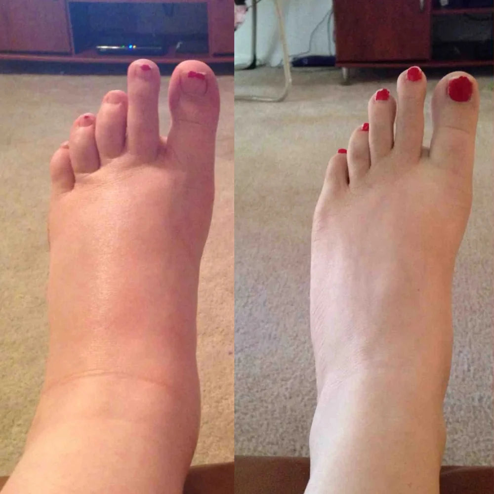 Lymora Lymphatic Drainage